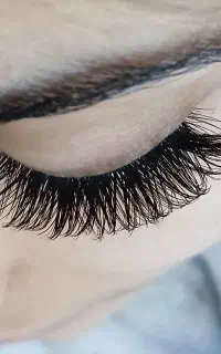 کاشت مژه
