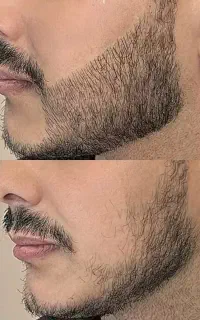 کوسه بیا جنگل برو