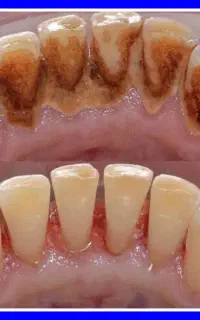 دندانپزشکی/کامپوزیت/ایمپلنت/عصبکشی/ترمیم جرمگیری