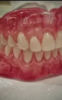تعمیر دندان و ساخت پروتز متحرک