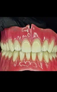 لابراتور دندانسازی