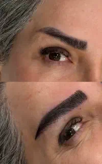 کاشت ابرو (میکرو کاشت )به روش تار به تار