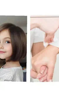 کوتاهی مو واپلاسیون