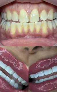 دندانپزشکی و دندانسازی دیجیتال اقساطی