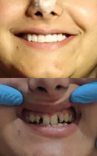 دندانپزشکی (تخفیف استثنائی و بدون تمدید)