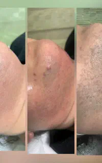 لیزر موهای زائد و کلیه خدمات زیبایی در مطب پزشک