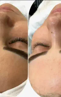 اصلاح درما + پاکسازی