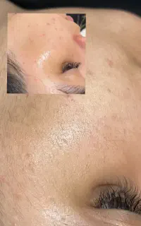 اصللاح درما و پاکسازی فقط ۳۰۰