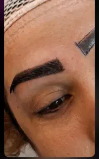 کاشت مو. ابرو. ریش اقساطی