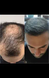 تار موی جدید و قوی