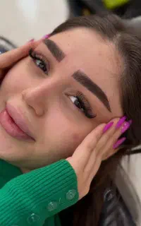 میکروبلیدینگ(فیبروزابرو)