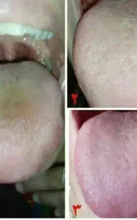 اموزش رایگان طب سنتی و علم زبانشناسی
