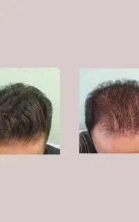 هنوزم دیر نشده میتونی درمانش کنی