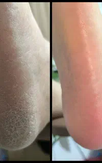 پدیکور و کفسابی بانوان
