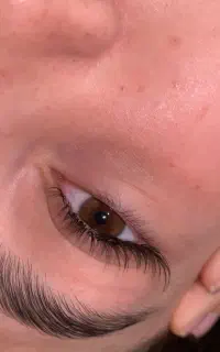 کاشت مژه