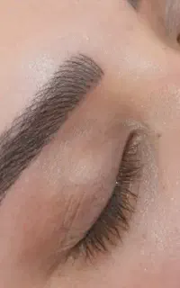 میکرو بلیدینگ و فیبروز ابرو