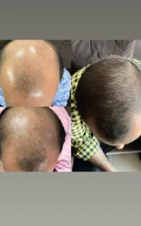خدافظ کم پشتی ریش مو
