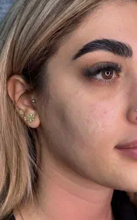 پیرسینگ مطبی گوش غضروف،گوشواره کودک، میکرودرمال