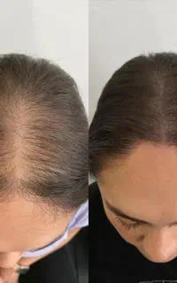 رشدموهات چندین برابر میشه