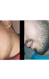 آیا ریش می خواهید
