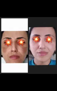 کرم روشن کننده انحصاری درخشان