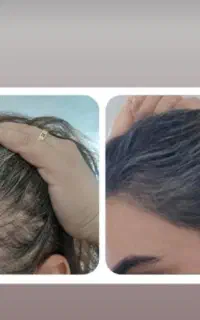 قابی باشکوه برای چهره شما
