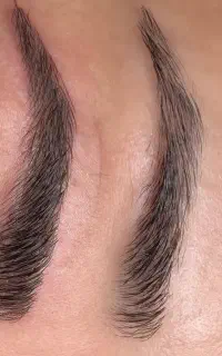 بن مژه/میکروی ابرو