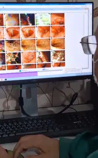 خدمات آندوسکوپی و کلونوسکوپی و بوتاکس معده
