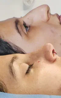 جشنواره عمل زیبایی بینی فقط 42 تومن
