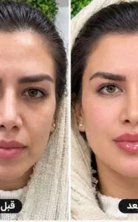 جشنواره فقط تا پنج شنبه فقط1/950با10خدمات رایگان