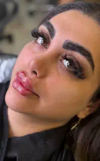 کیلینیک تخصصی ژل و‌بوتاکس مزو فیلر بادی باسن