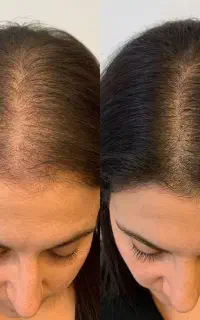 تغذیه ریشه با ترکیبات گیاهی