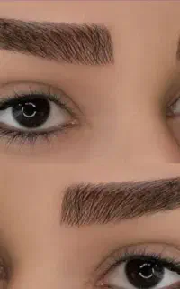 فیبروز.میکرو.تاتوبدن