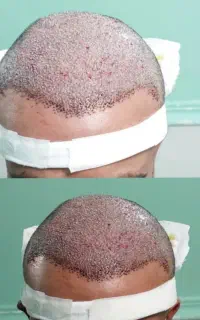 کاشتمو شیرازی فول تراکم