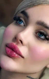 تخفیف ژل و بوتاکس آنزیم پی ار پی مزوتراپی