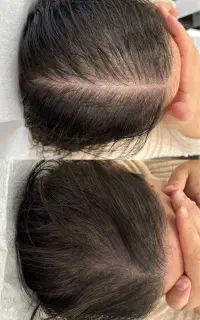 از افسردگی نجاتت میدم