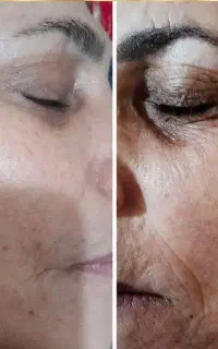 خداحافظی با چروک هات