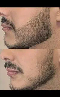 کاشت ممنوع شد