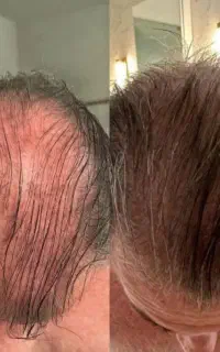 دور کمپشتی رو خط بکش