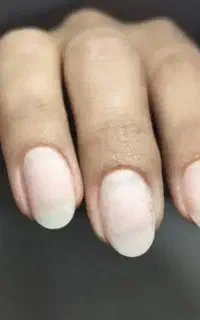 کاشت ناخن