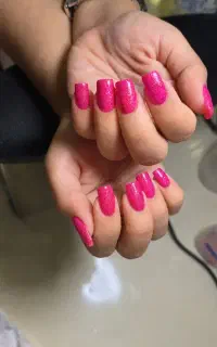 تخفیف ویژه مدل ترمیم ژل و لمینت