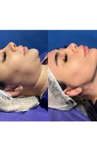 معروف‌ترین پزشک و جراح سوپرکانتورینگ vوی لاین