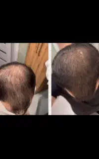 موهات طاس نشده یه فکری به حالش کن