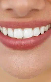 استخدام ادمین اینستاگرام برای کلینیک دندانپزشکی