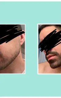 پسر بی ریش باشه کنسله