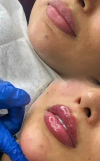 ارائه و آموزش خدمات تخصصی ژل و بوتاکس