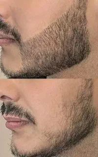 ریش داشته باش تا ریشه دار باشی