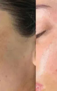 تمام چین و چروک از بین میبره تضمینی و با 50%تخفیف
