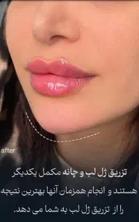 «دکتر کامبیز محمدپور»گلدیلاک،روسی، اورجینال