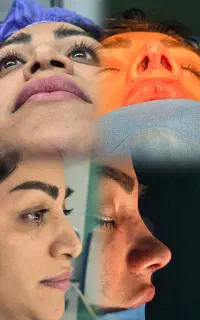 عمل بینی با قیمت اقتصادی پزشک متخصص در تهران